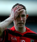 Cappataggle forward Martin Broderick, leaves the Croke Park pitch with a badly gashed head wound, during the AIB GAA All-Ireland Intermediate Club Hurling Final.